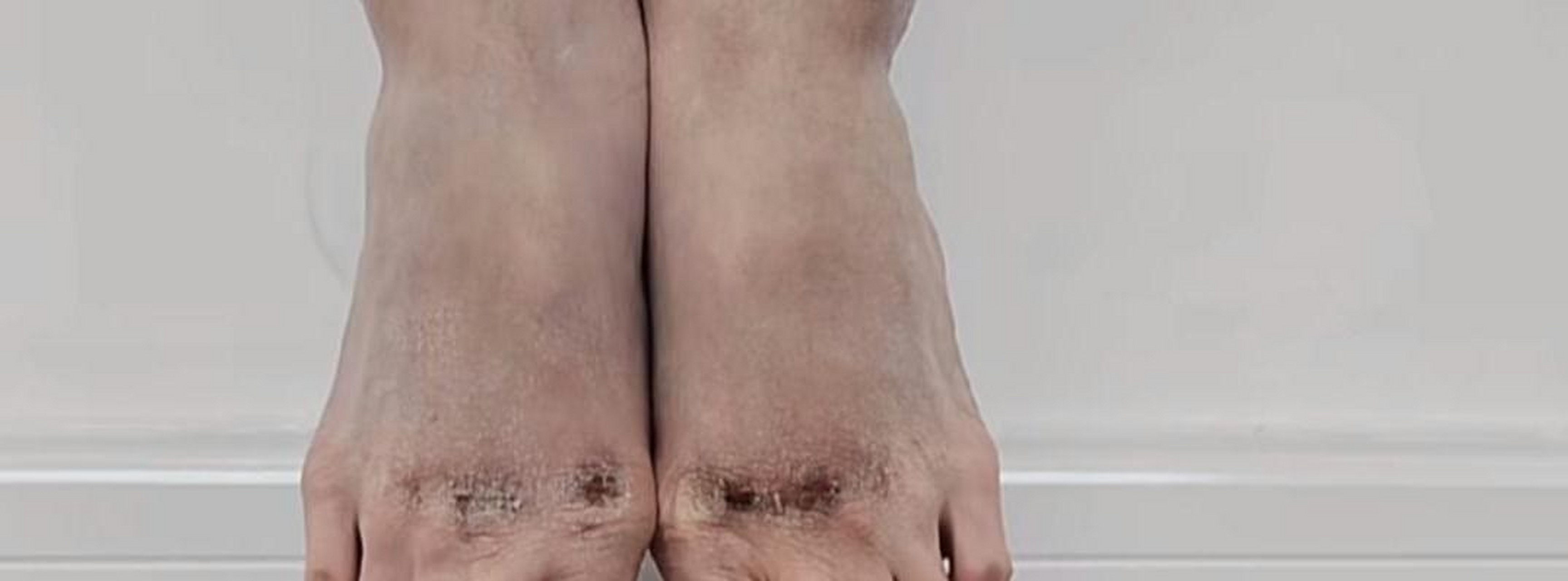 芭蕾舞演员的脚很痛苦[开心]