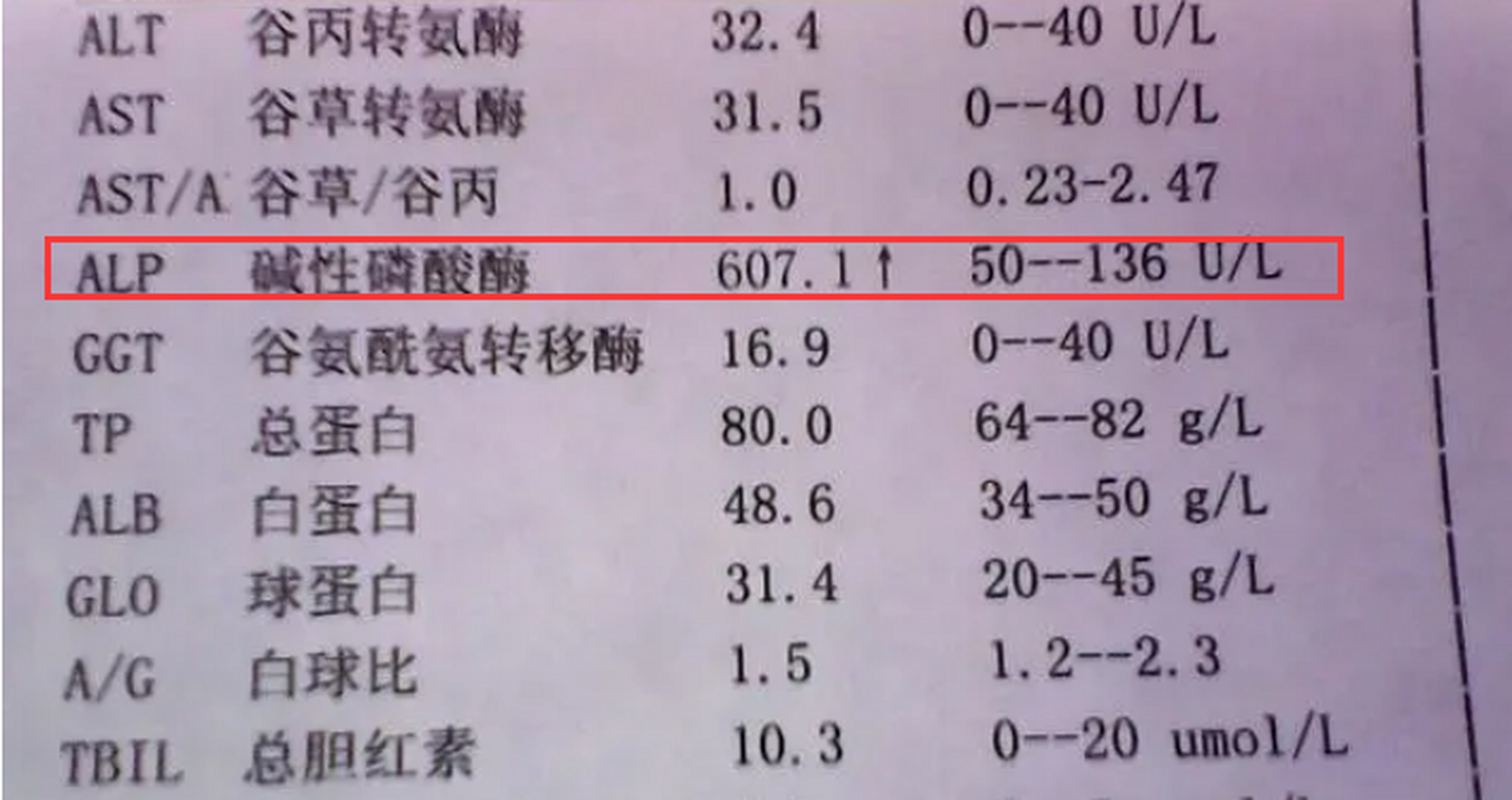 儿童碱性磷酸酶300多图片