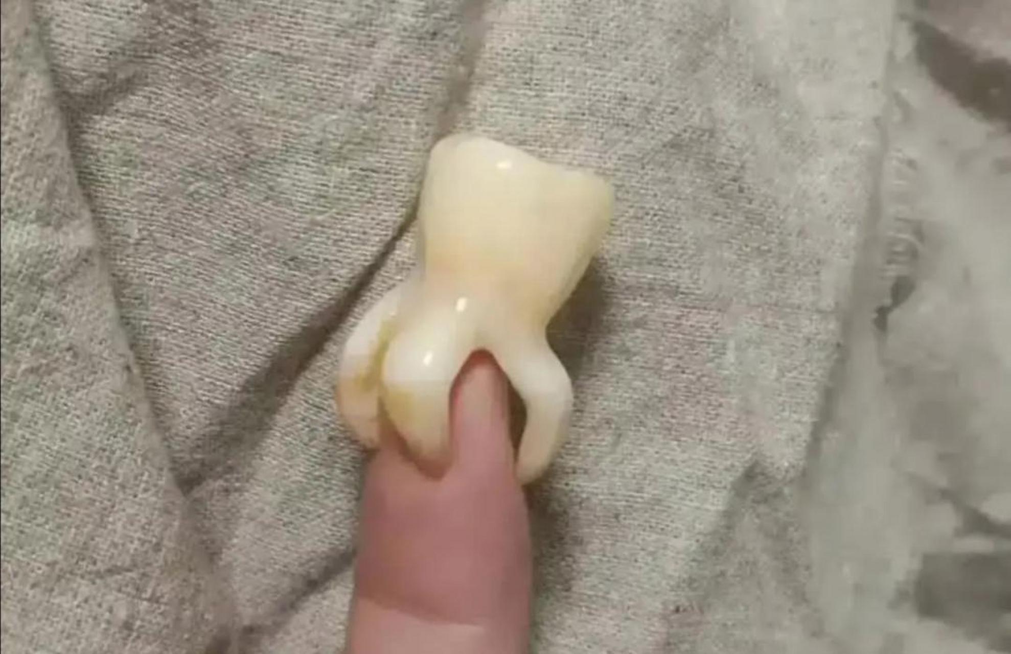 拔出这颗牙齿花了我1000元.它贵吗?