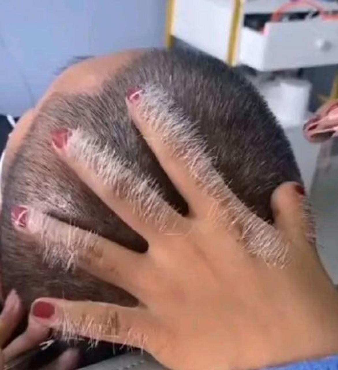 白头发真的会越拔越多吗 #趣图搞笑