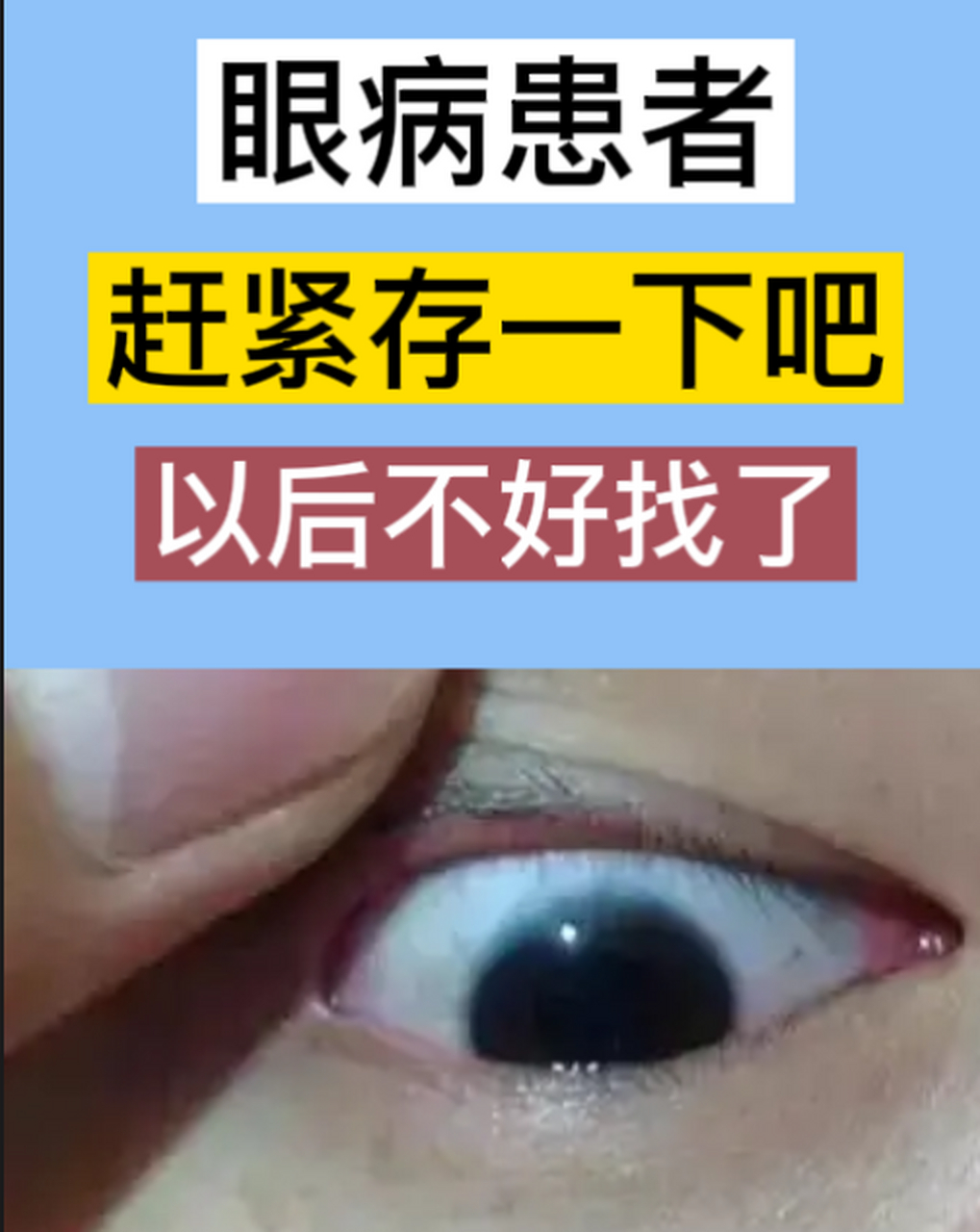 中国中医科学院眼科医院核磁加急-中国中医科学院眼科医院 视光中心 