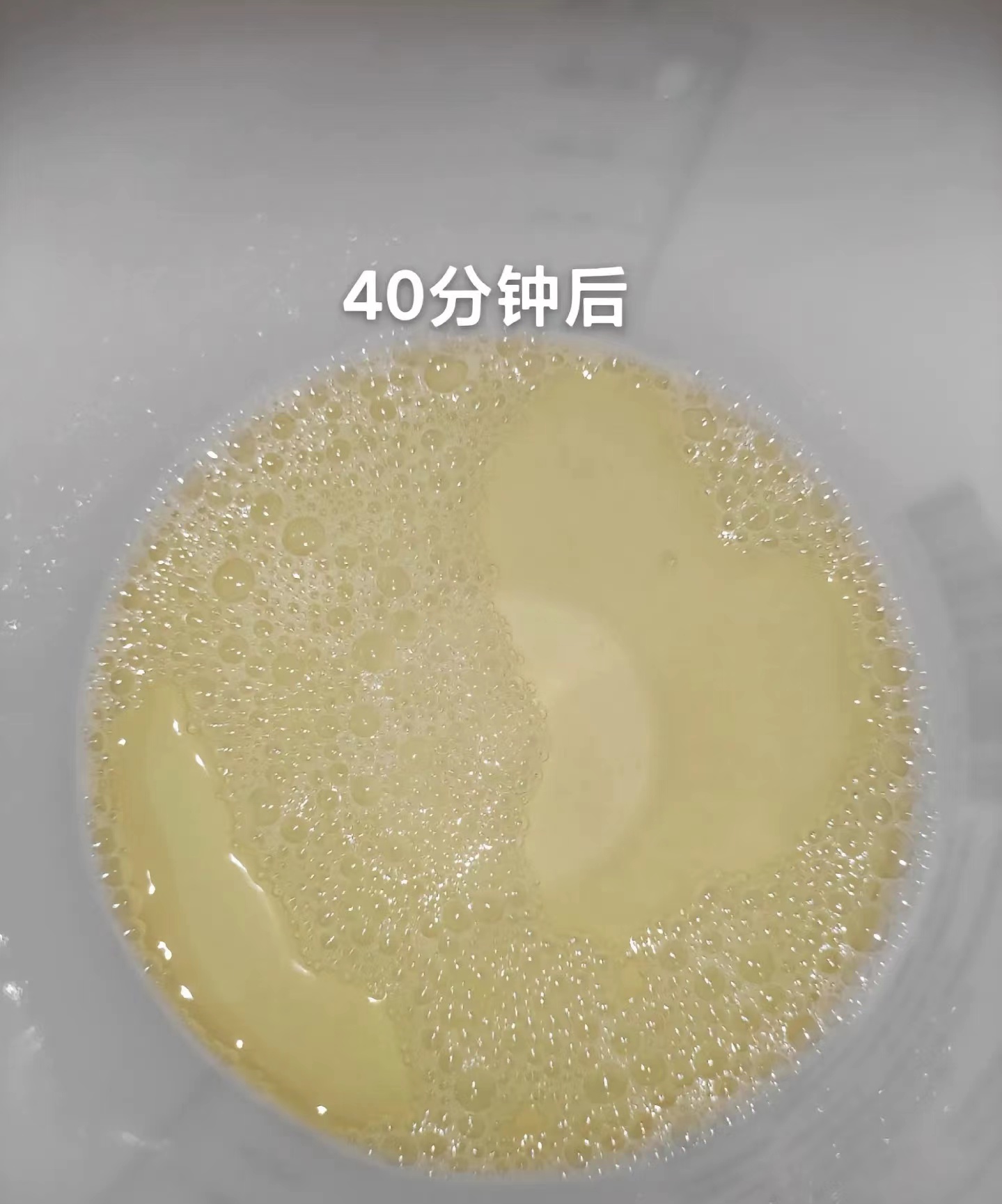 最近有粉丝问我为什么我的尿蛋白没有消失反而多了?