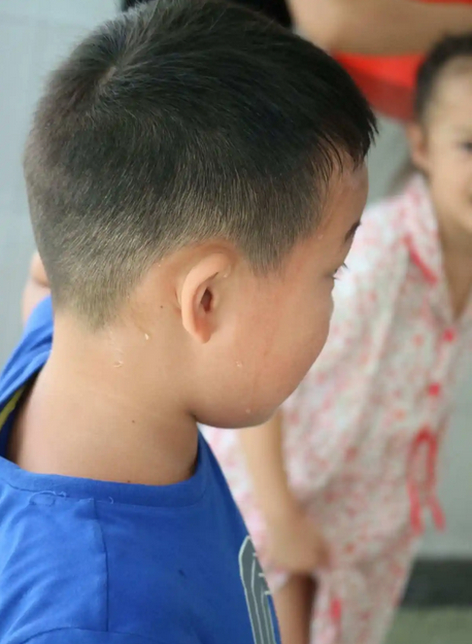 热射病是最危险的中暑,作为高温杀手,尤其对于老人小孩来说如果救治