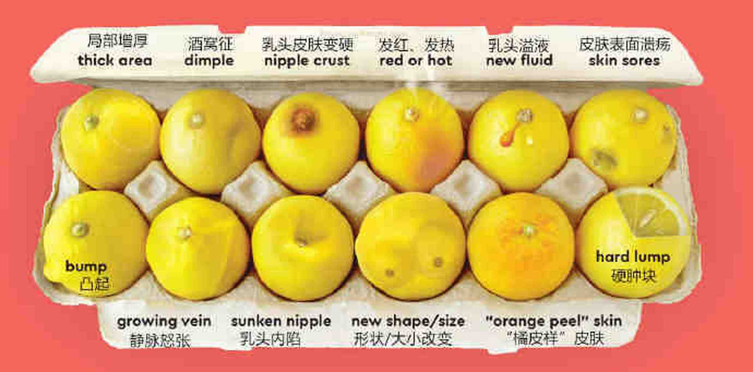 your lemons用柠檬解释了12种乳房的外观改变,非常直观!