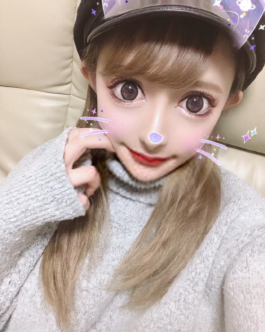 整成漫画里的"卡姿兰大眼睛"真的好看吗?