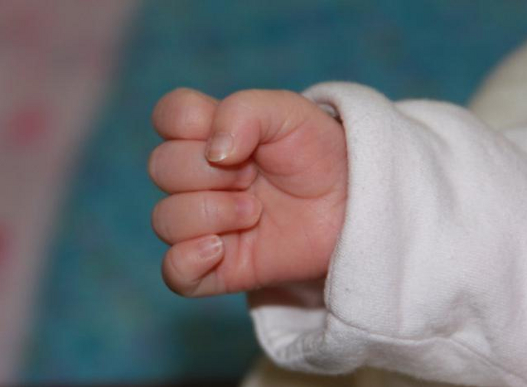 小婴儿总是手握拳正常吗?什么情况下是异常的?