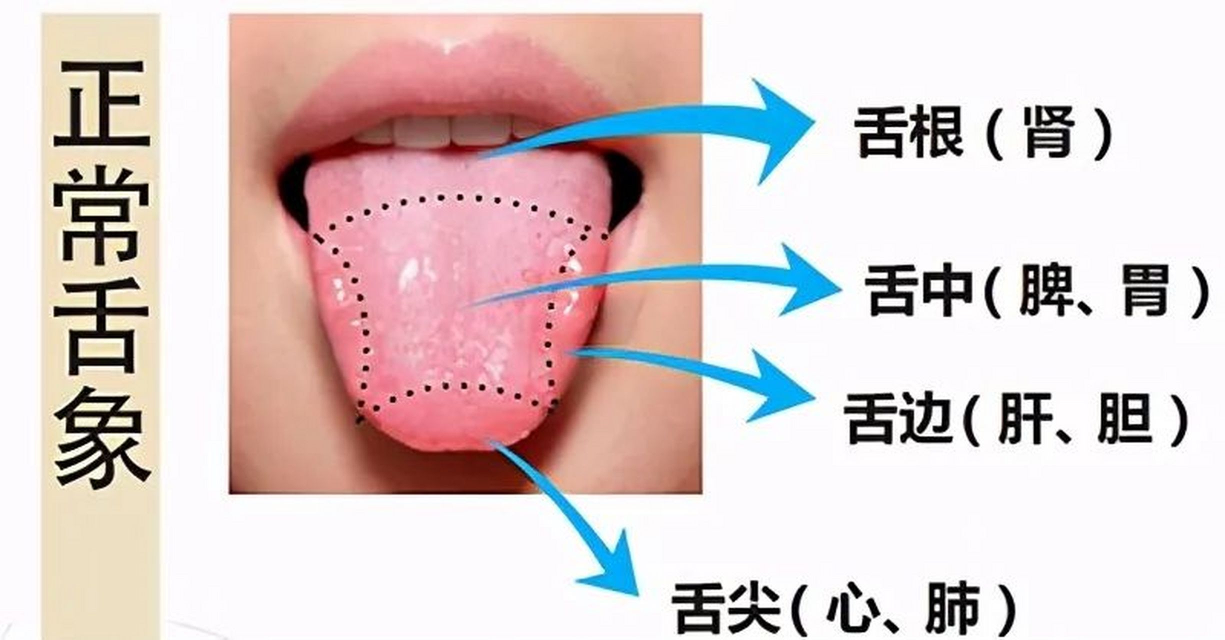 舌头不同位置,相对应的五脏 五脏在舌头均有反射区,舌尖是反应心肺