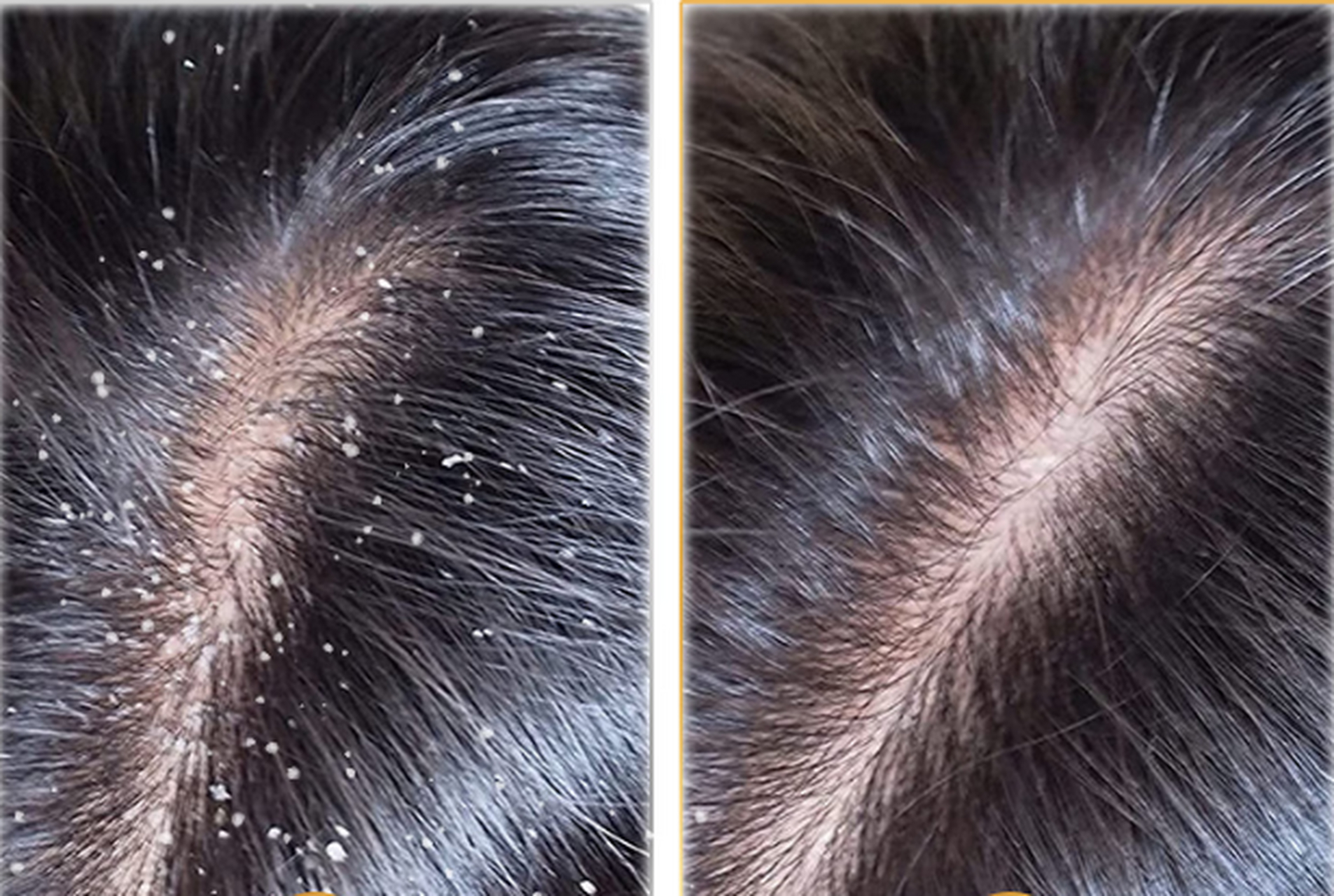 但是,使用了花诉妍专研去屑净爽洗发乳后,情况发生了改变.