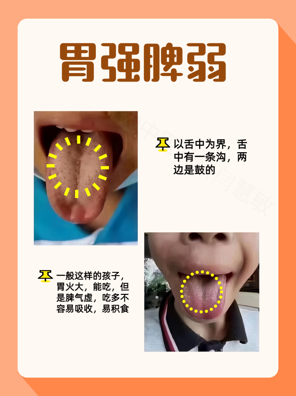 孩子胃强脾弱的典型情况 以舌中为界,舌中有一