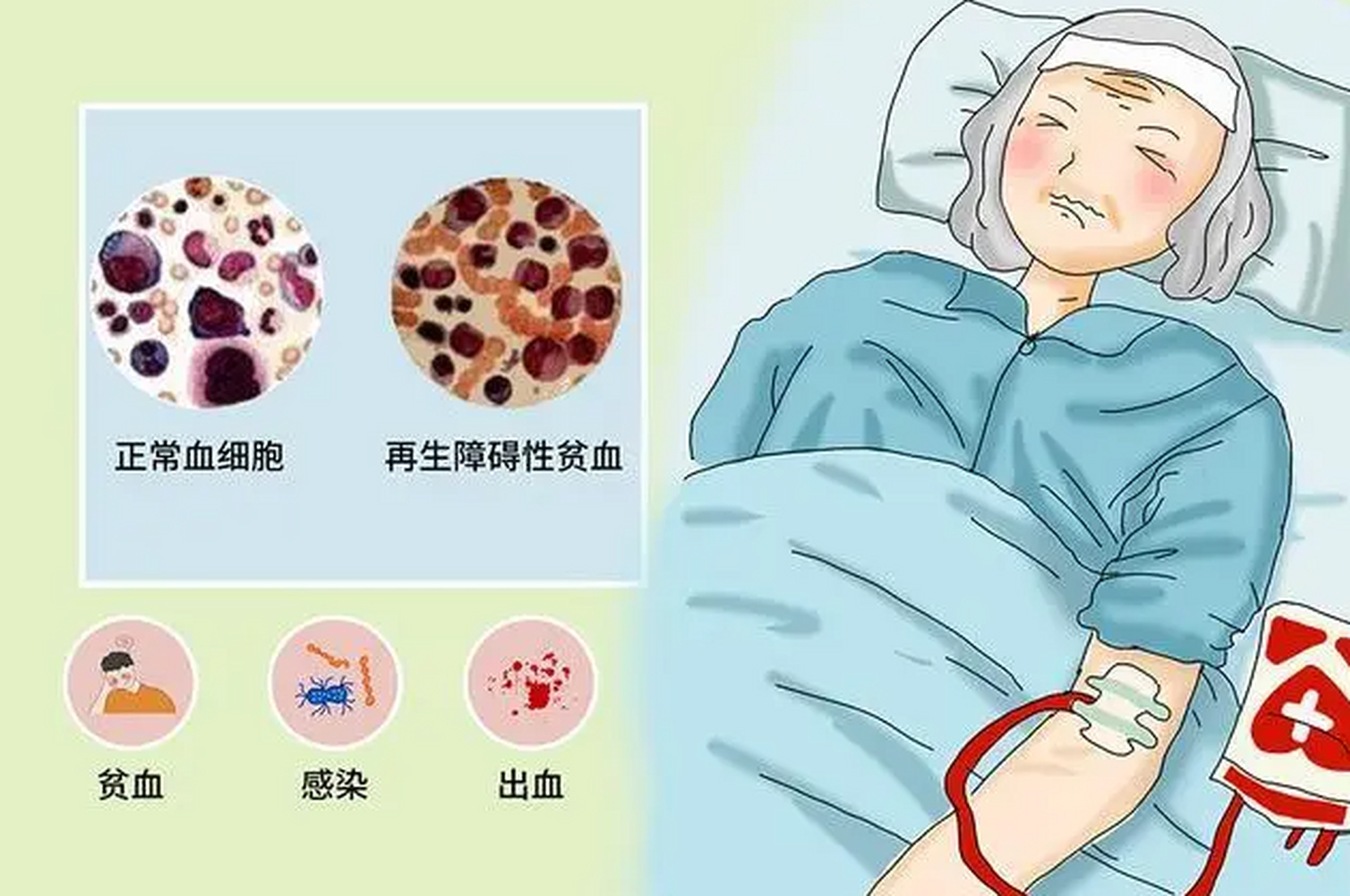 大家好,我是血液科肖医生[爱你]~ 再生障碍性贫血目前最主要的表现