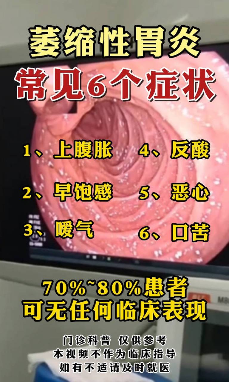 萎缩性胃炎,是通过c1 c2 c3来划分病变的范围,之后,根据病情轻重,我们