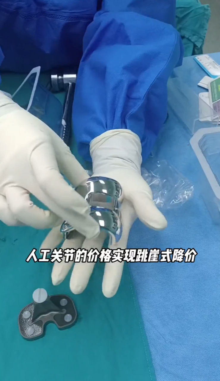 目前一套进口的人工膝关节,也才需要四五千块钱.