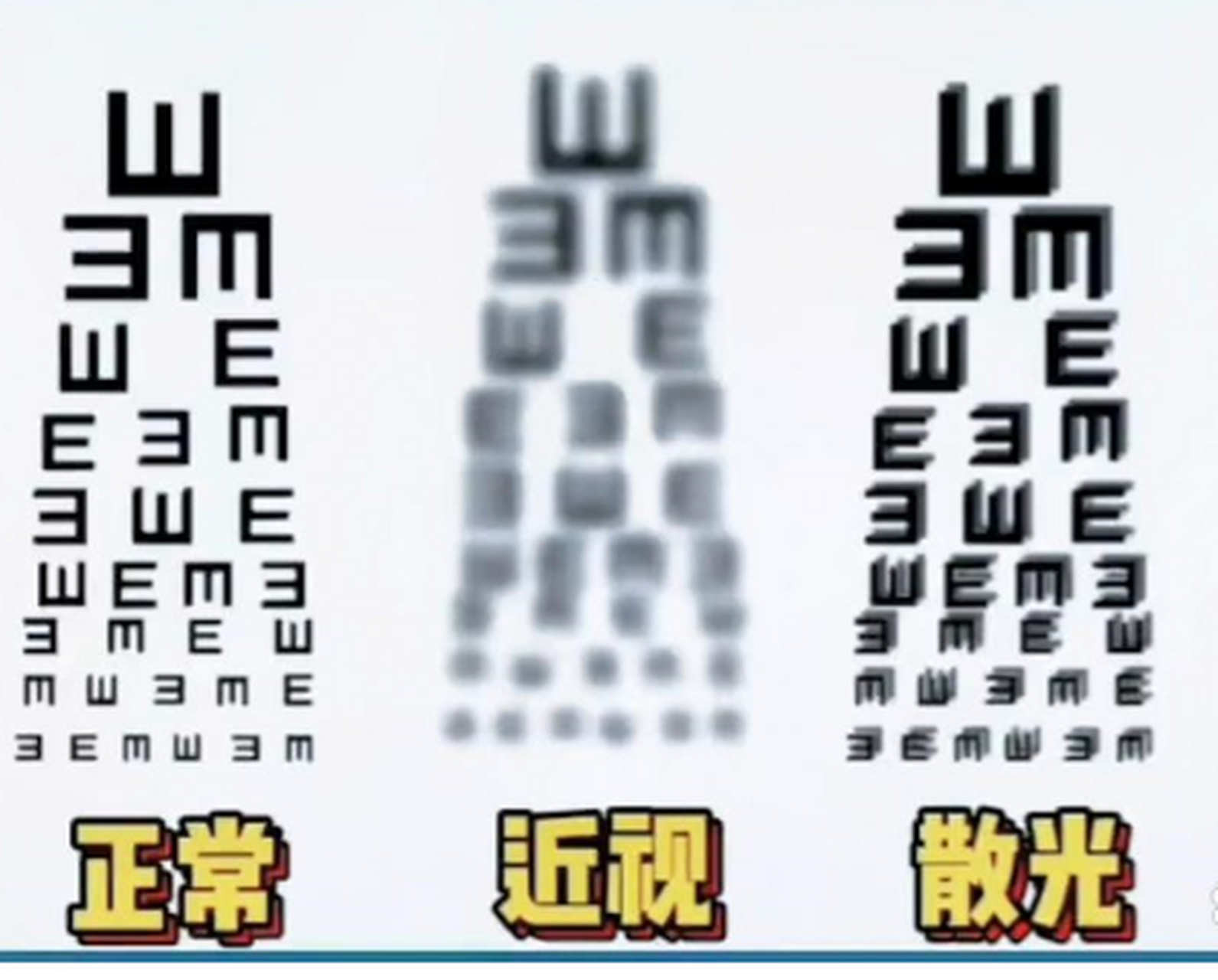 一张图教你看懂近视和散光