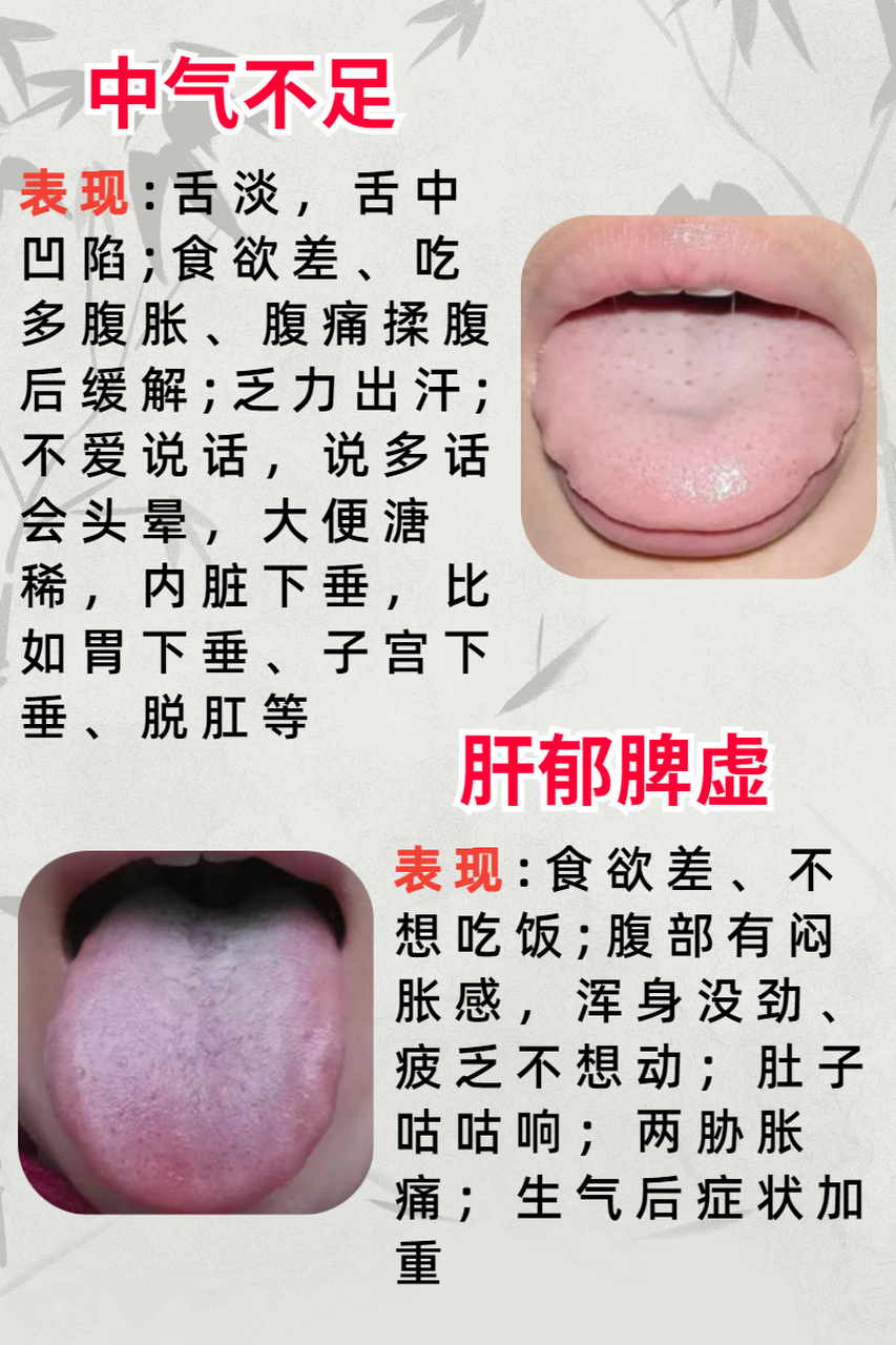 万病源于脾,脾不好,都会有哪些表现?