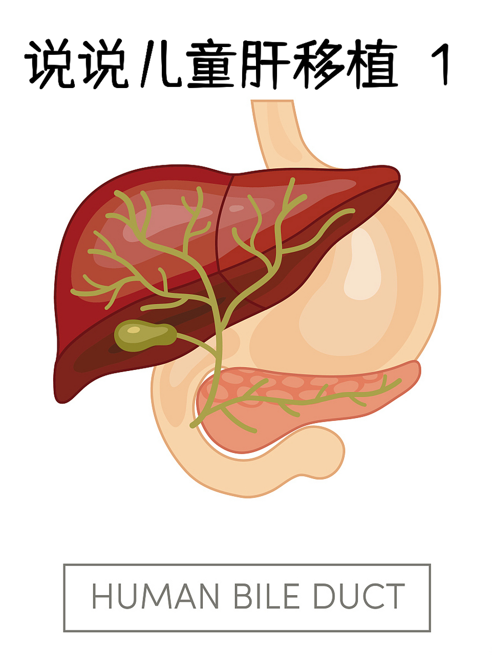 胆道闭锁分型图片