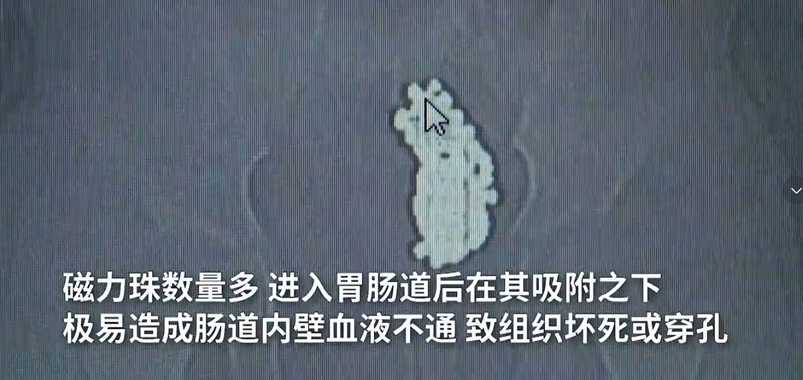 误食一颗磁力球会怎样_误食了磁力珠会怎么样