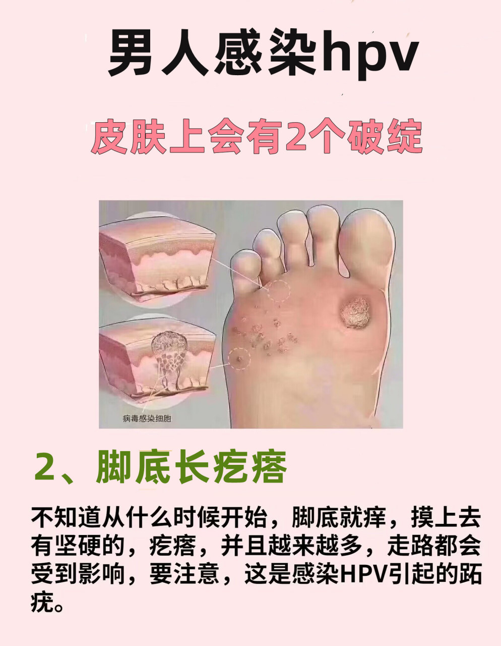 男人感染hpv,皮肤上会有2"破绽"!