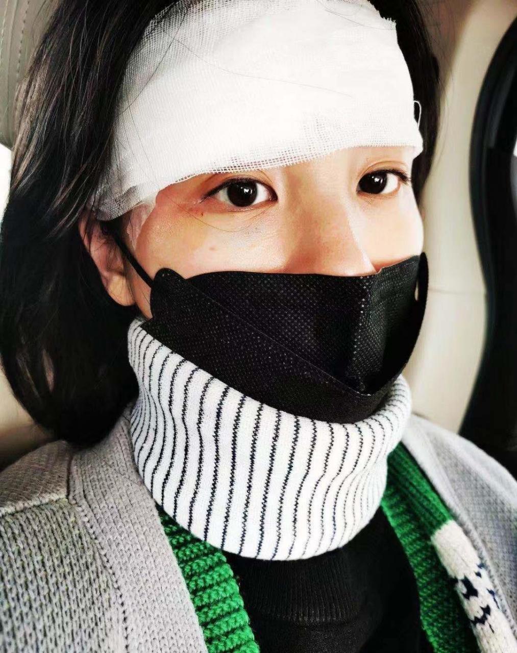 惊险!上海知名女星章龄之在酒店摔倒险破相 头缠纱布眼皮红肿显憔悴