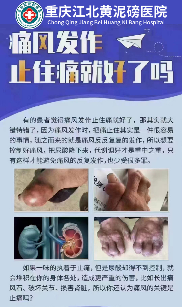 重庆最好的类风湿医院#重庆痛风医院排名前三 重庆渝北痛风医