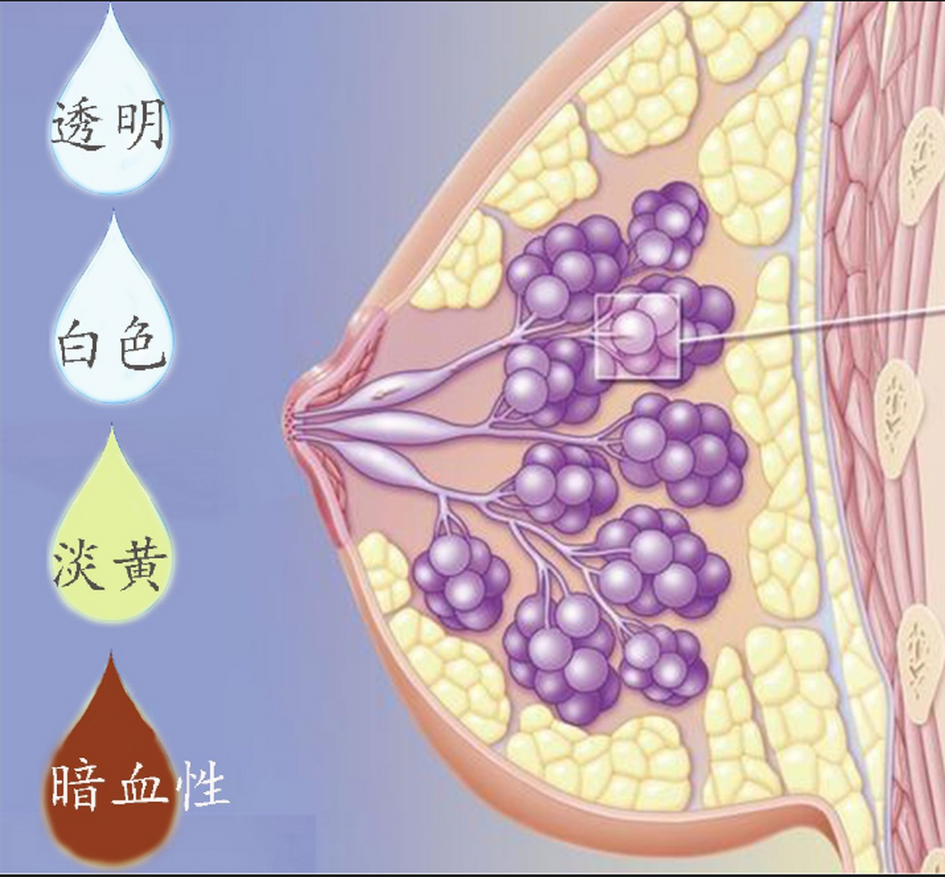 【不同颜色的乳头溢液意味着什么,应该怎么办?