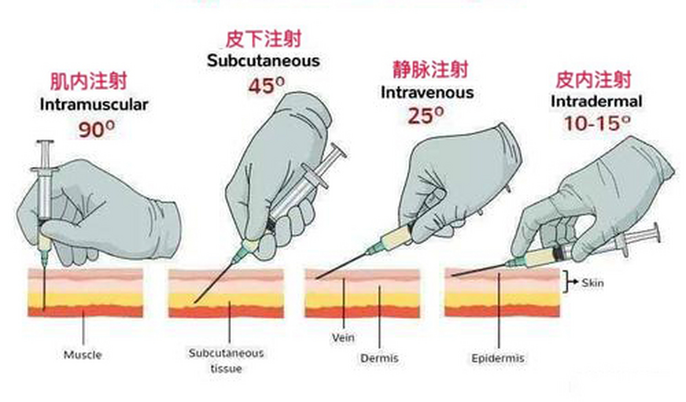 持注射针手法图片