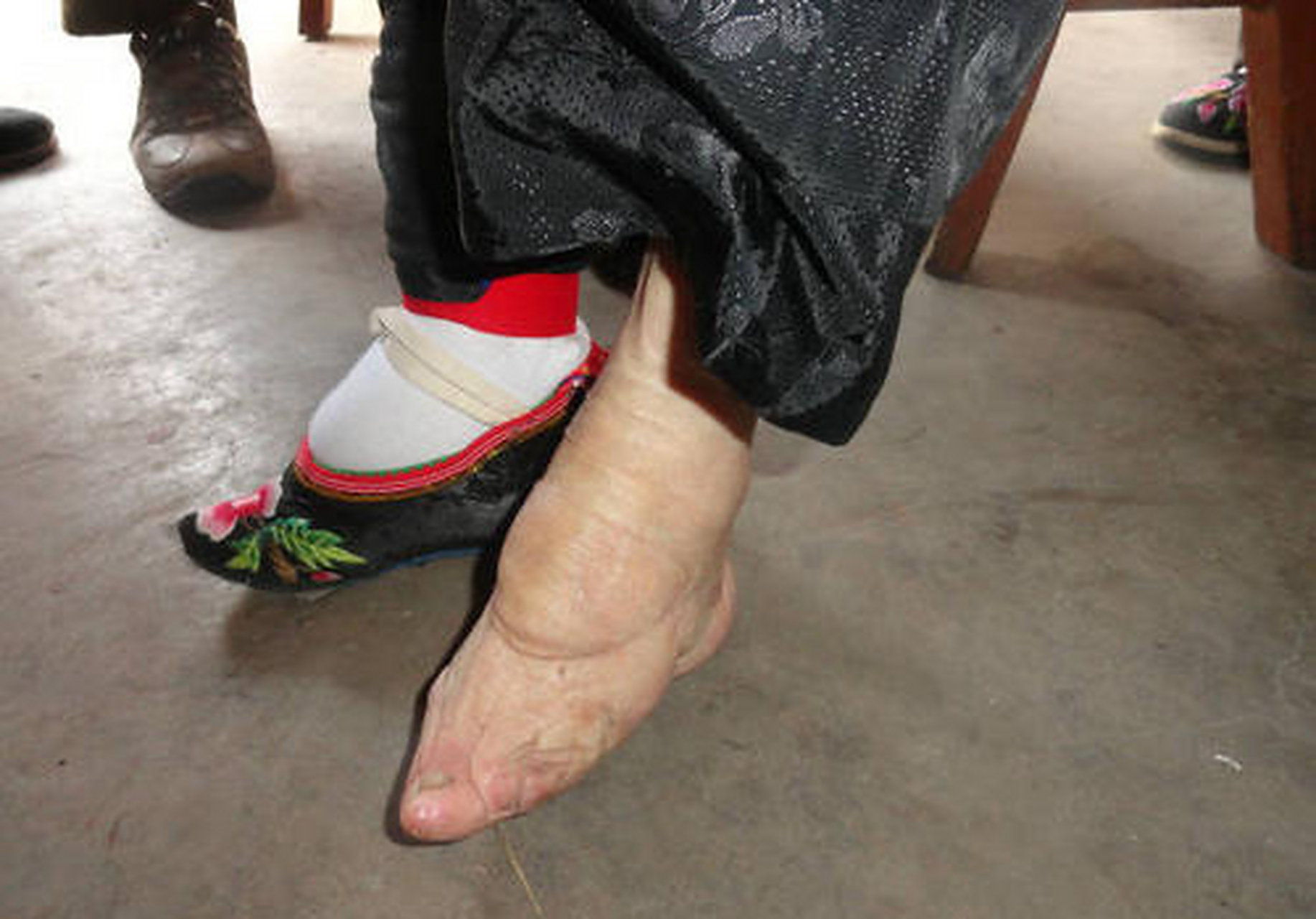 缠足是封建礼教对女性的摧残!