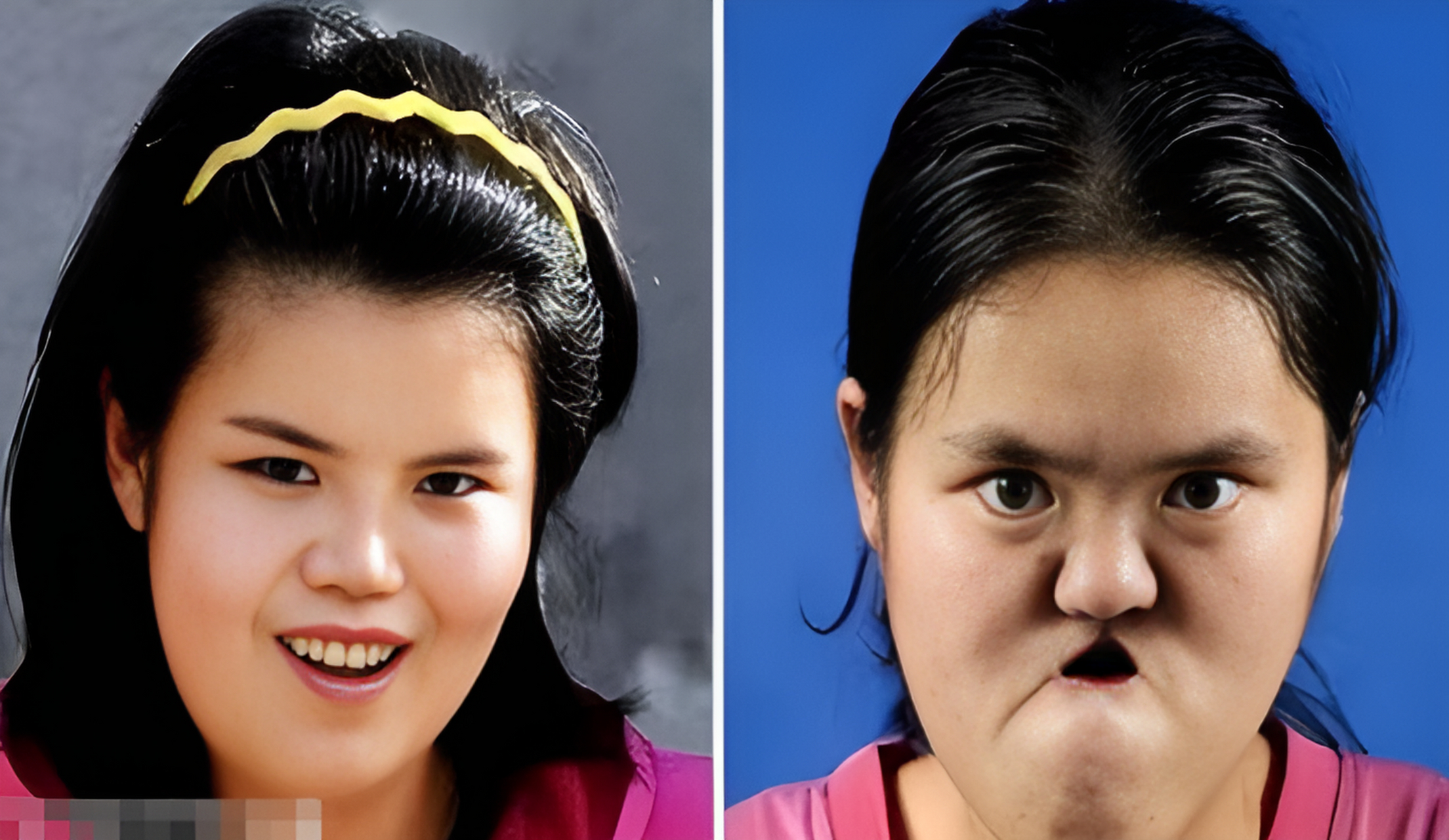 陕西的王友仁在坑面发现了一个弃婴,这个孩子没有鼻子和嘴巴,脸上有三