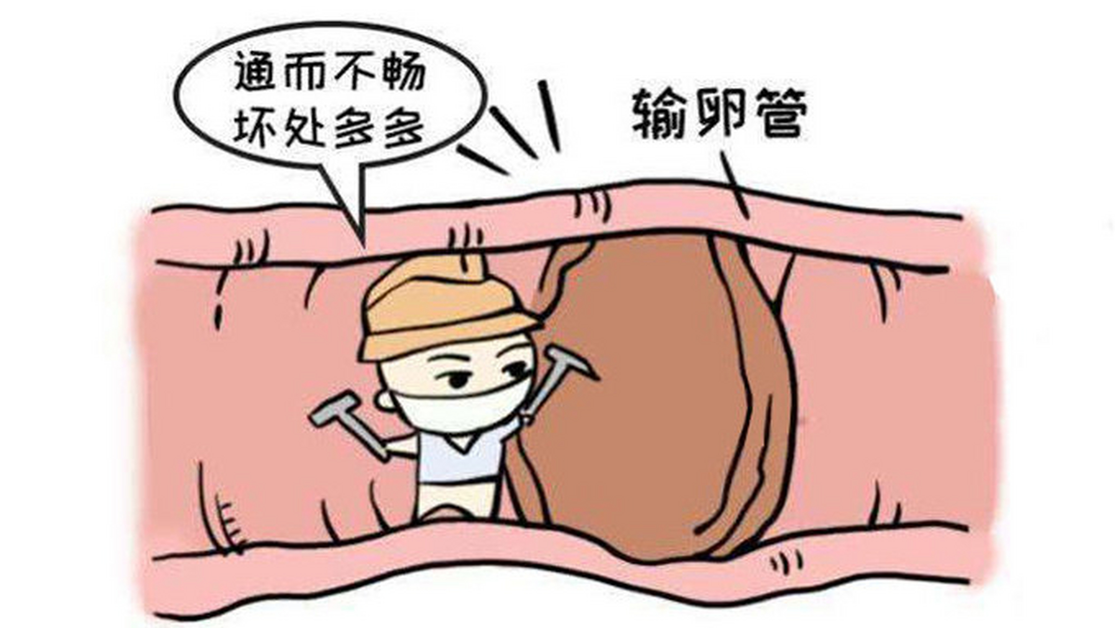 差异何在!输卵管堵塞怎么治疗最好"成功案例"-第2张图片-若克网