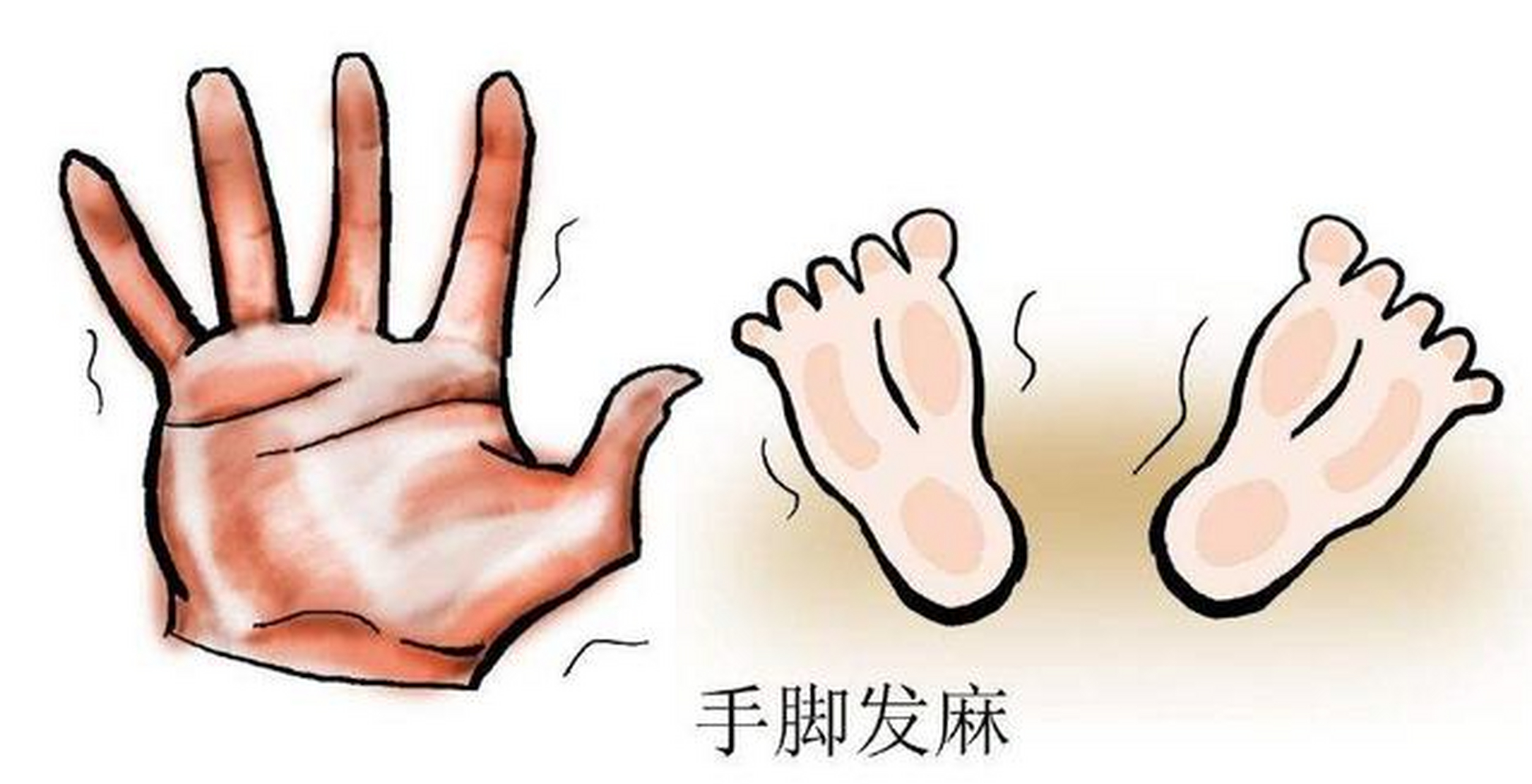 很多人都被手麻脚麻被这个问题困扰,活动一下可以