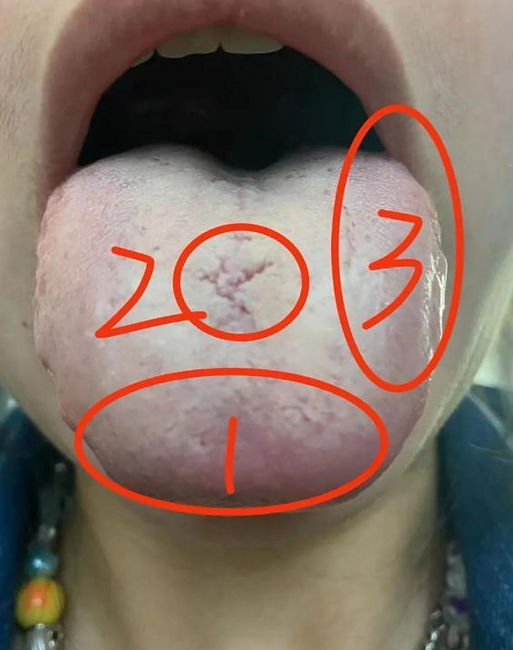 月经黑色 ,来月经会胸部胀痛,会腰酸,腹胀腹泻,口干舌燥 ,舌苔厚腻