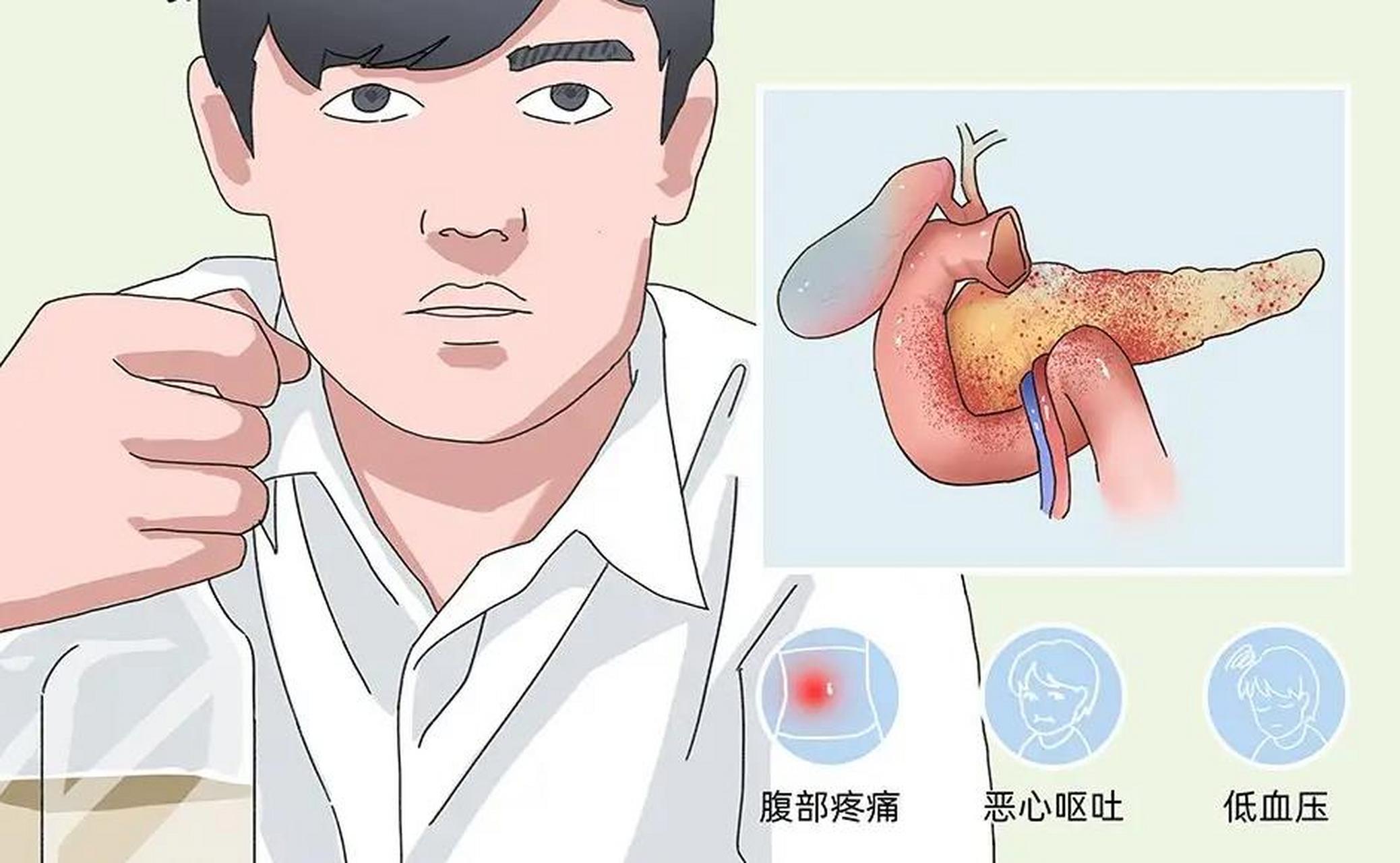 胰腺炎症状包括以下几个方面: 1,轻度胰腺炎:一般以腹痛,腹胀为主