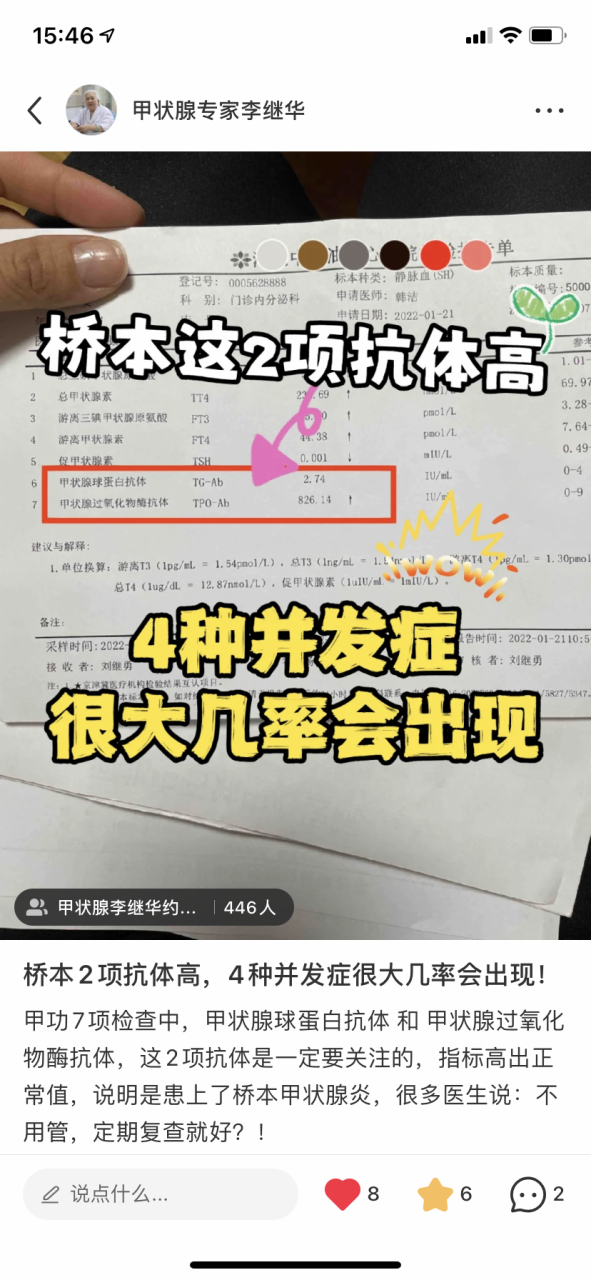 桥本氏甲状腺炎,2项抗体高,4种并发症会出现!