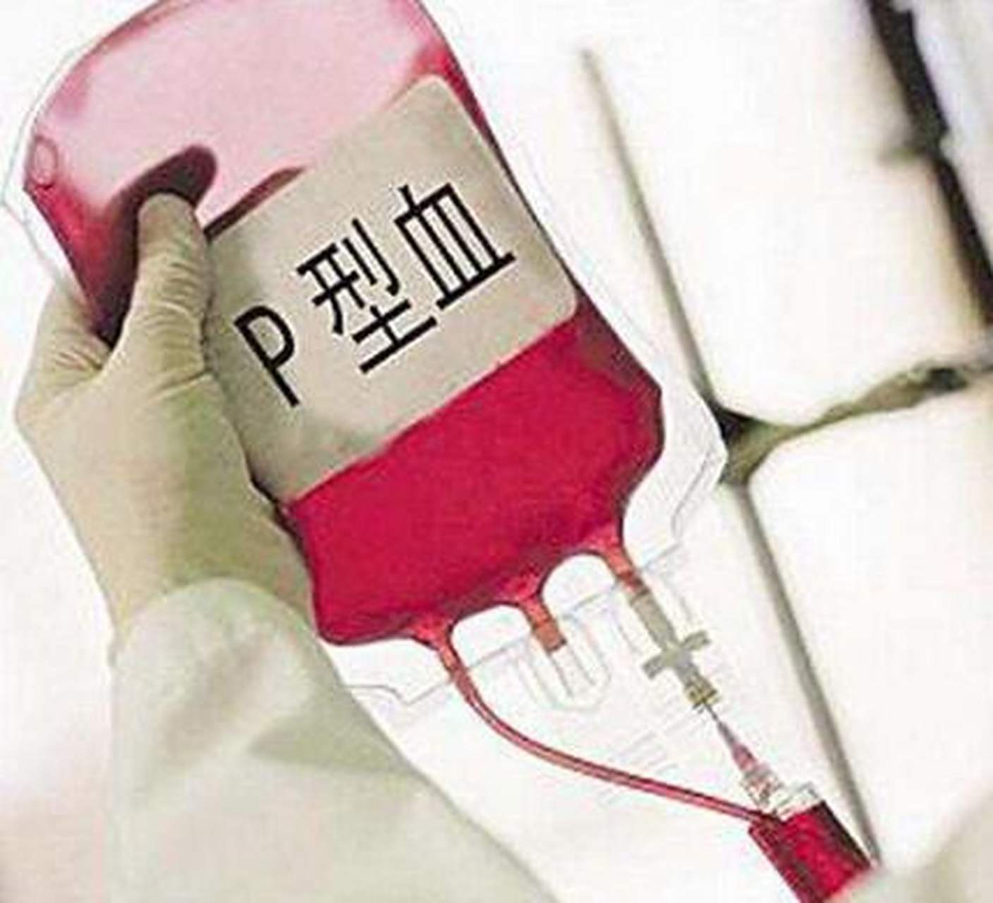 日本电视剧《血疑》又让人们知道了rh阴性.那么,你听说过p型血吗?