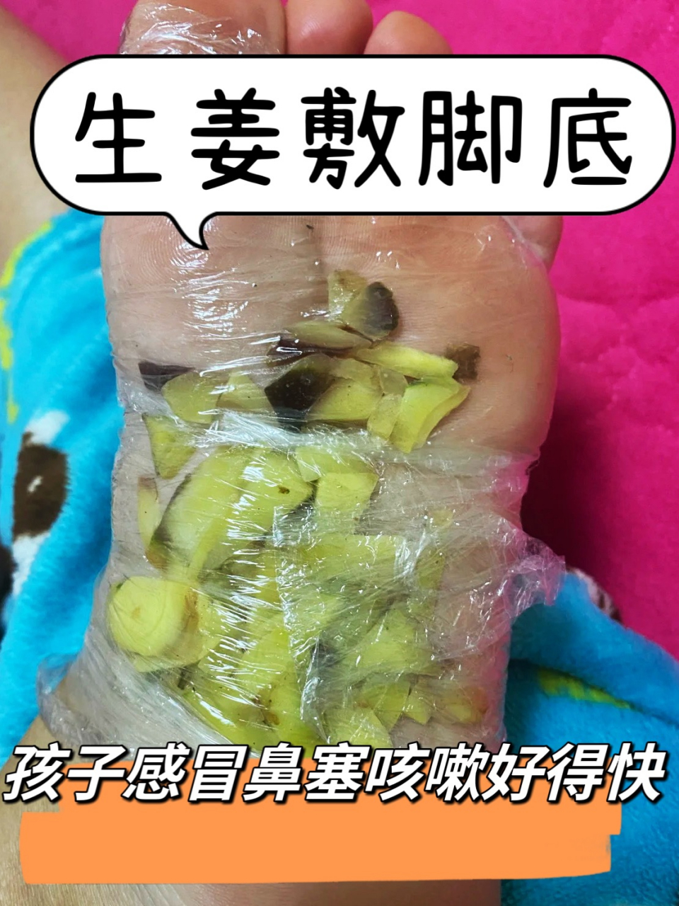 生姜敷脚底,孩子感冒鼻塞咳嗽好得快 ~ 冬天孩子稍微