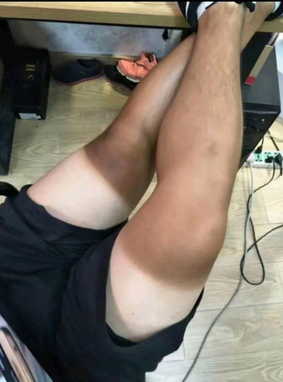 广东天气太热了,都晒成非洲人了,大家也是这样吗[左捂脸]