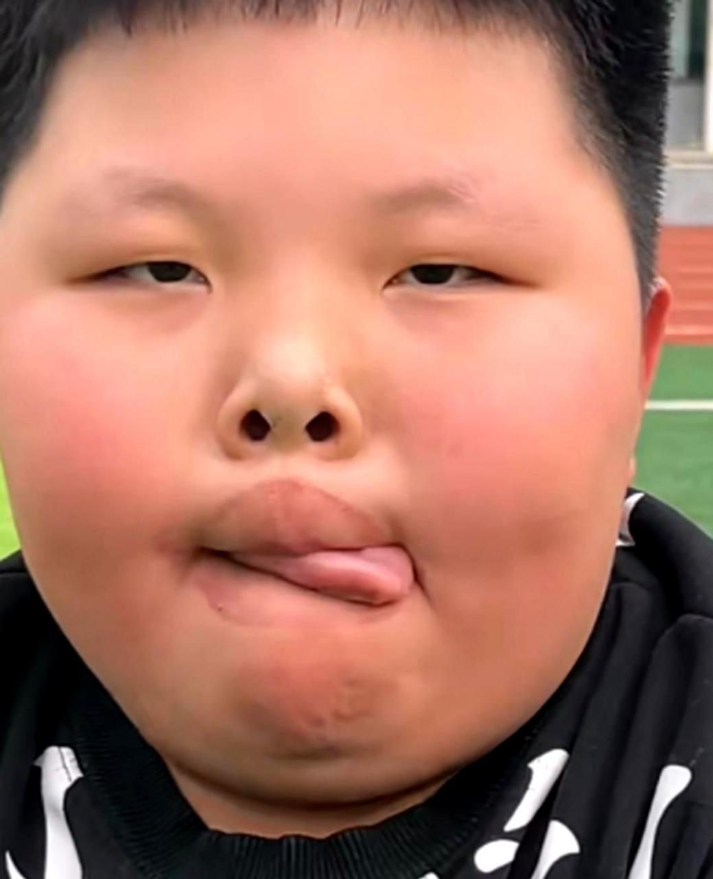 孩子舔嘴唇的不良习惯必须及时纠正,否则会影响口腔健康.