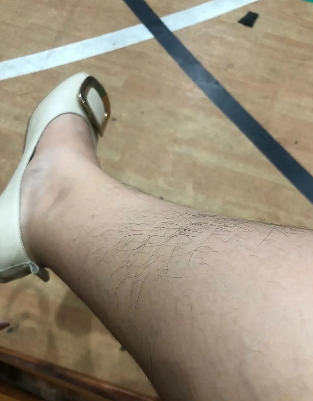 一个女生的腿毛这么多,正常吗?