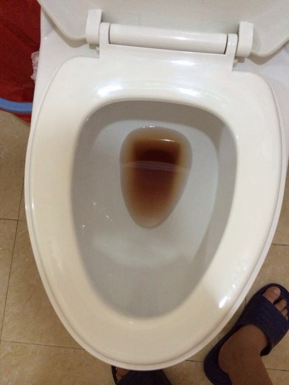 健康生活# #两性健康#  小便尿血是怎么回事呢?