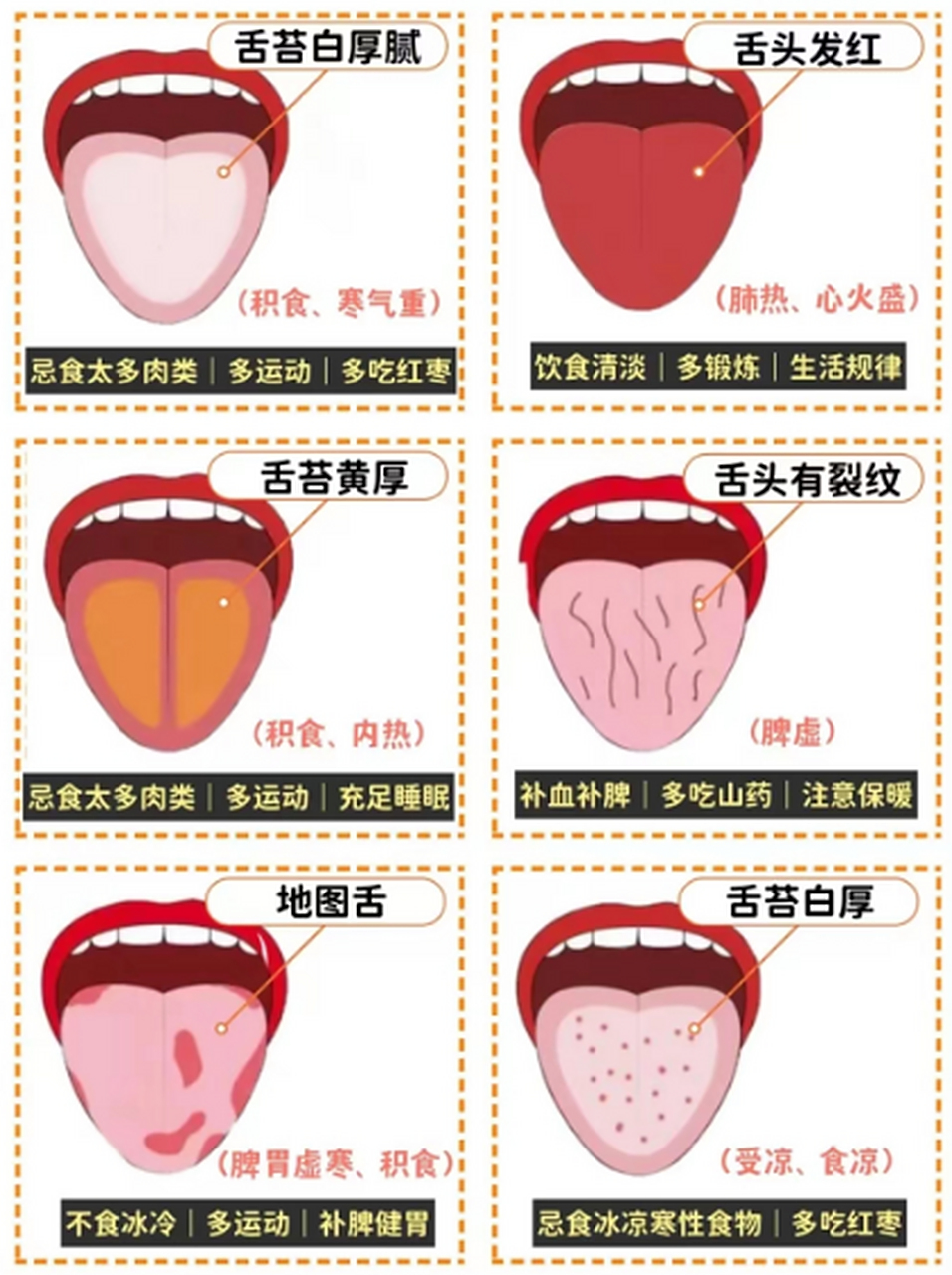 1,舌苔白厚腻:说明积食严重,寒气重 指南1:少吃肉,多吃新鲜蔬菜,多