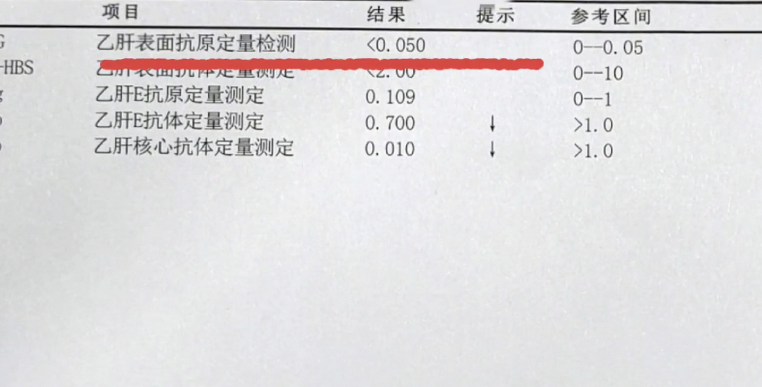 乙肝表面抗原阳性图片