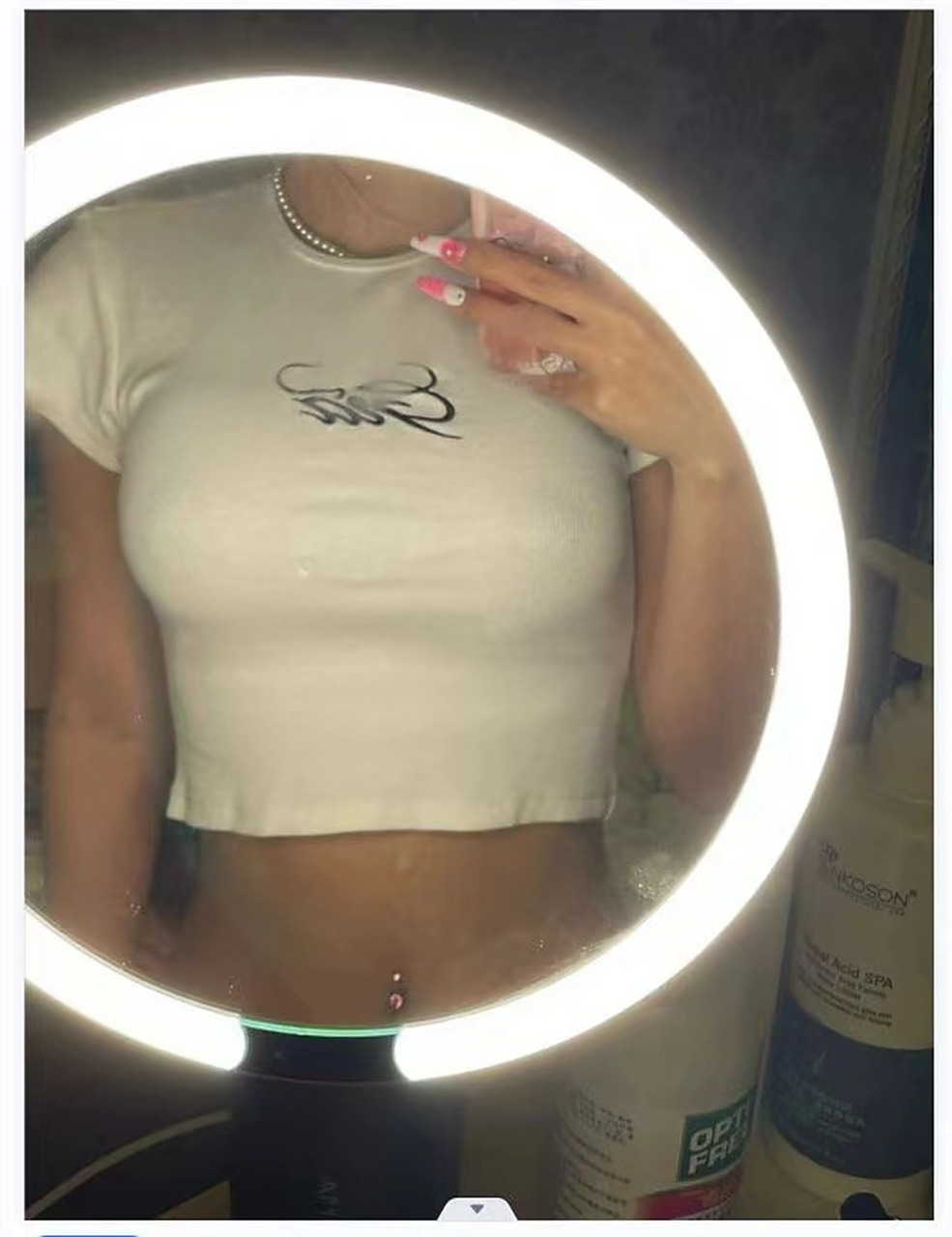 隆胸术后一年,做以前的a罩杯到现在的c罩杯,不仅身材挺拔了,人也活得