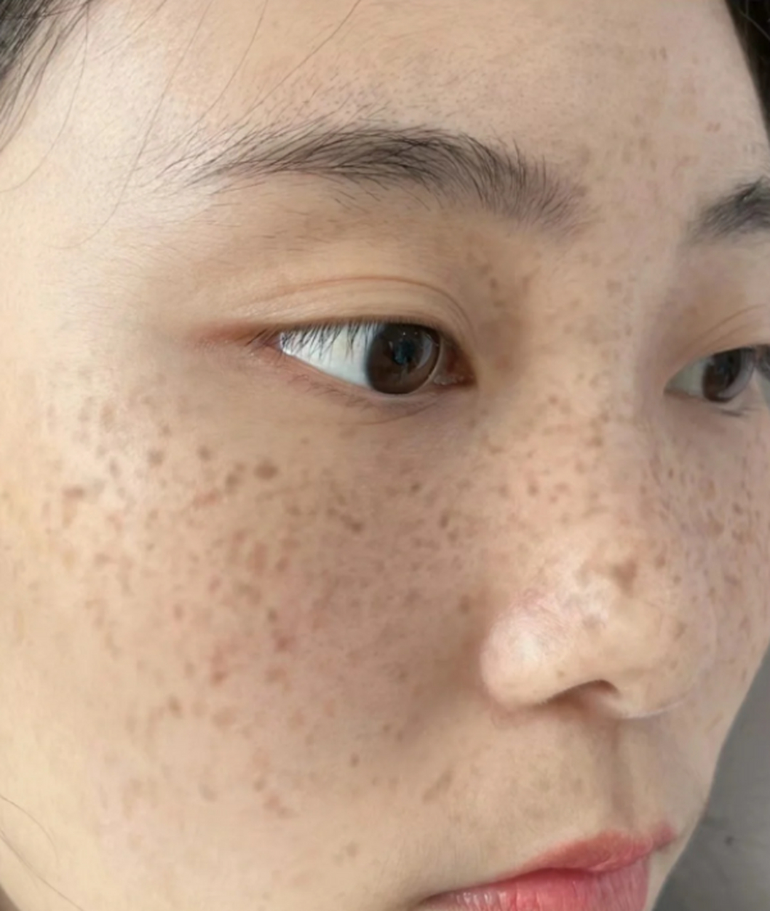 黄褐斑是我长期以来一直困扰的皮肤问题之一.