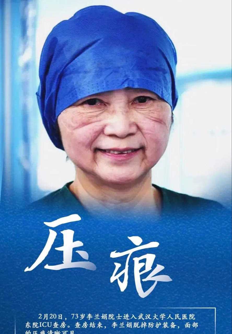 她,只是一个老人,73岁的李兰娟院士脸上的压痕让人心疼![庆祝]