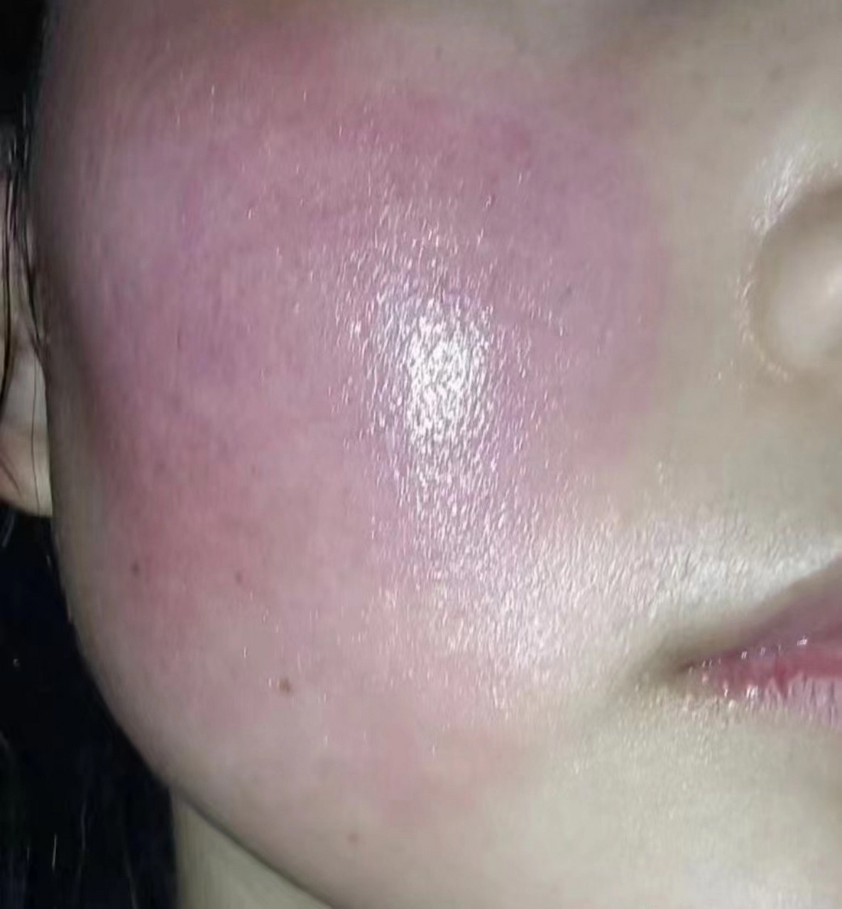 "我的皮肤又过敏了" "我的皮肤又肿起来了" "我的皮肤有红块了好痒"