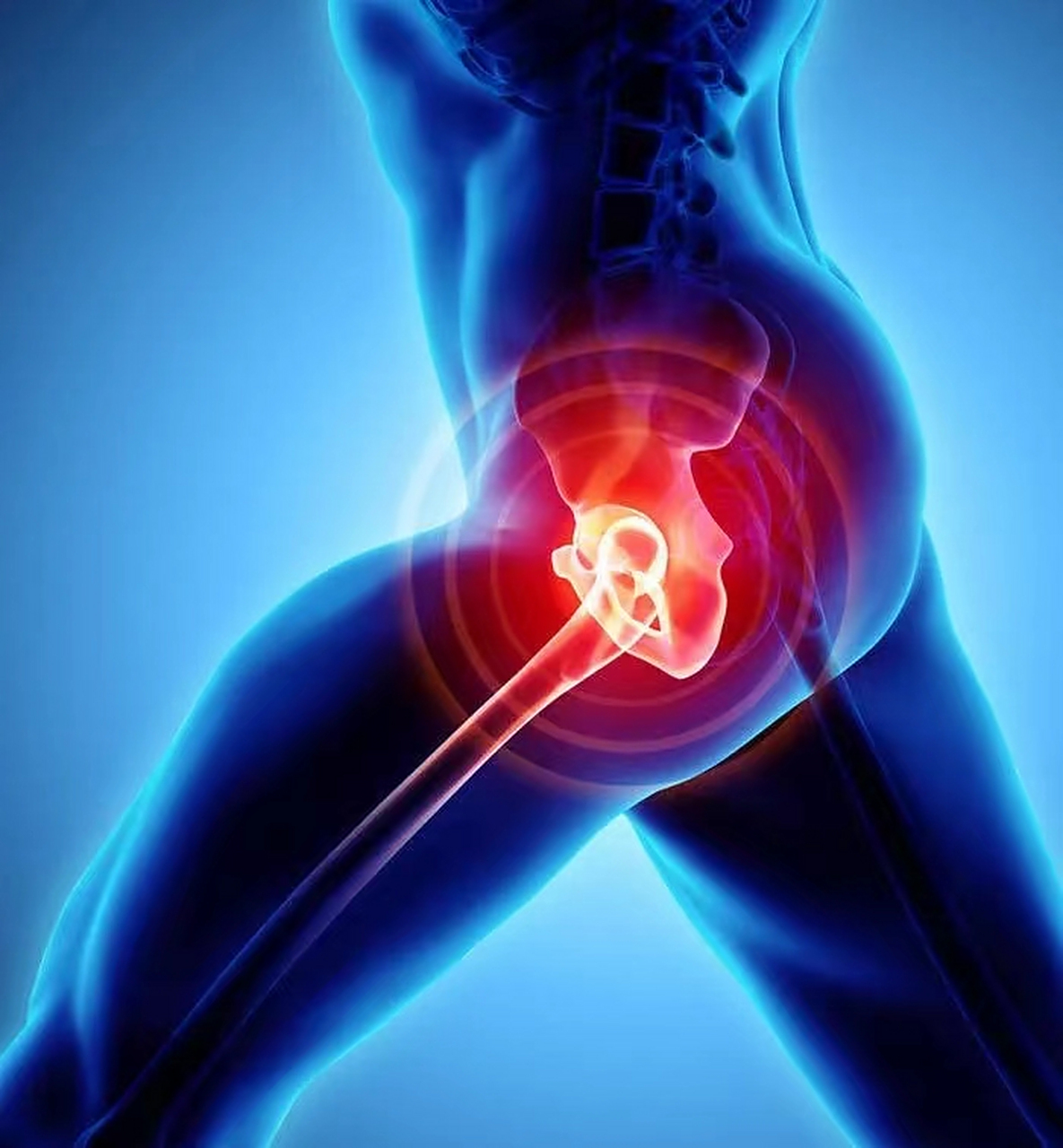 如果你出现了髋部疼痛,不用过于惊慌,耽误您20秒,耐心听我说完您就