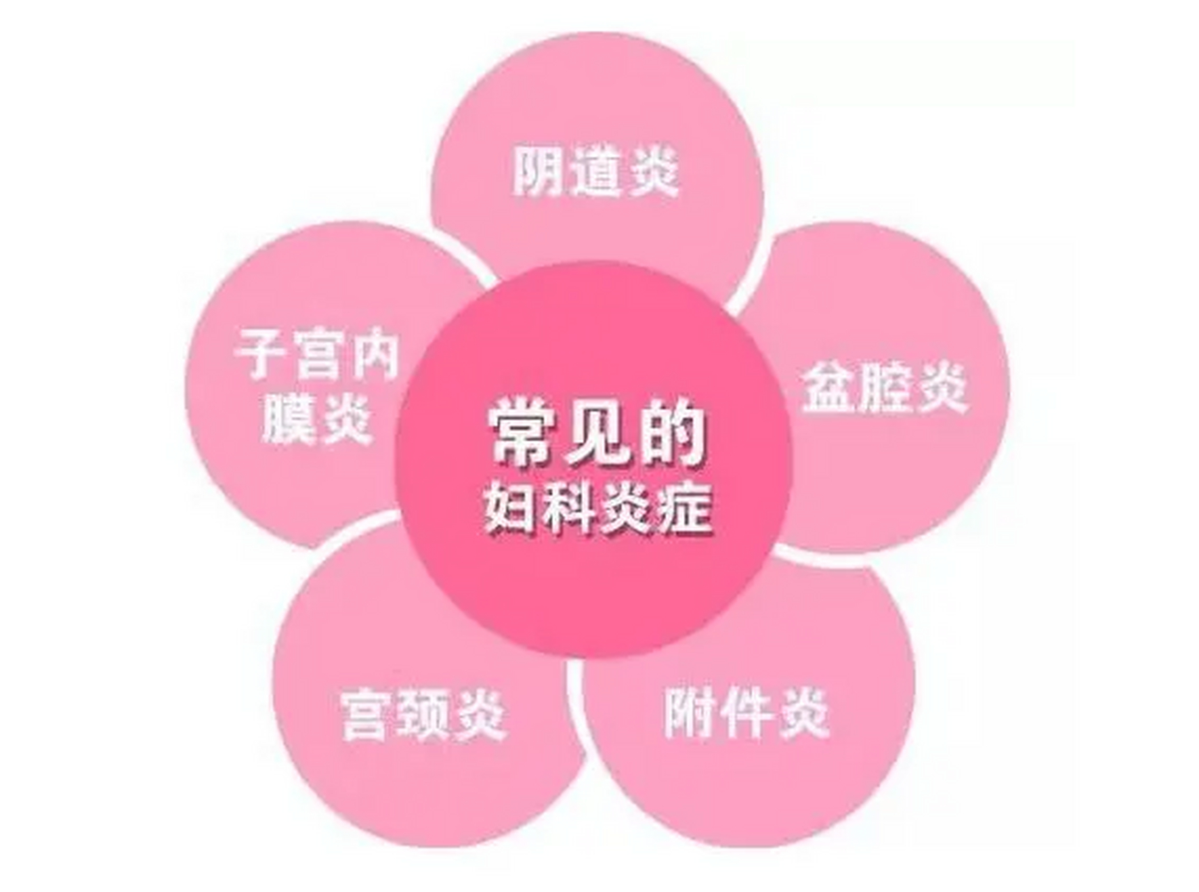 妇科炎症一直是女性生活中的一大难题.