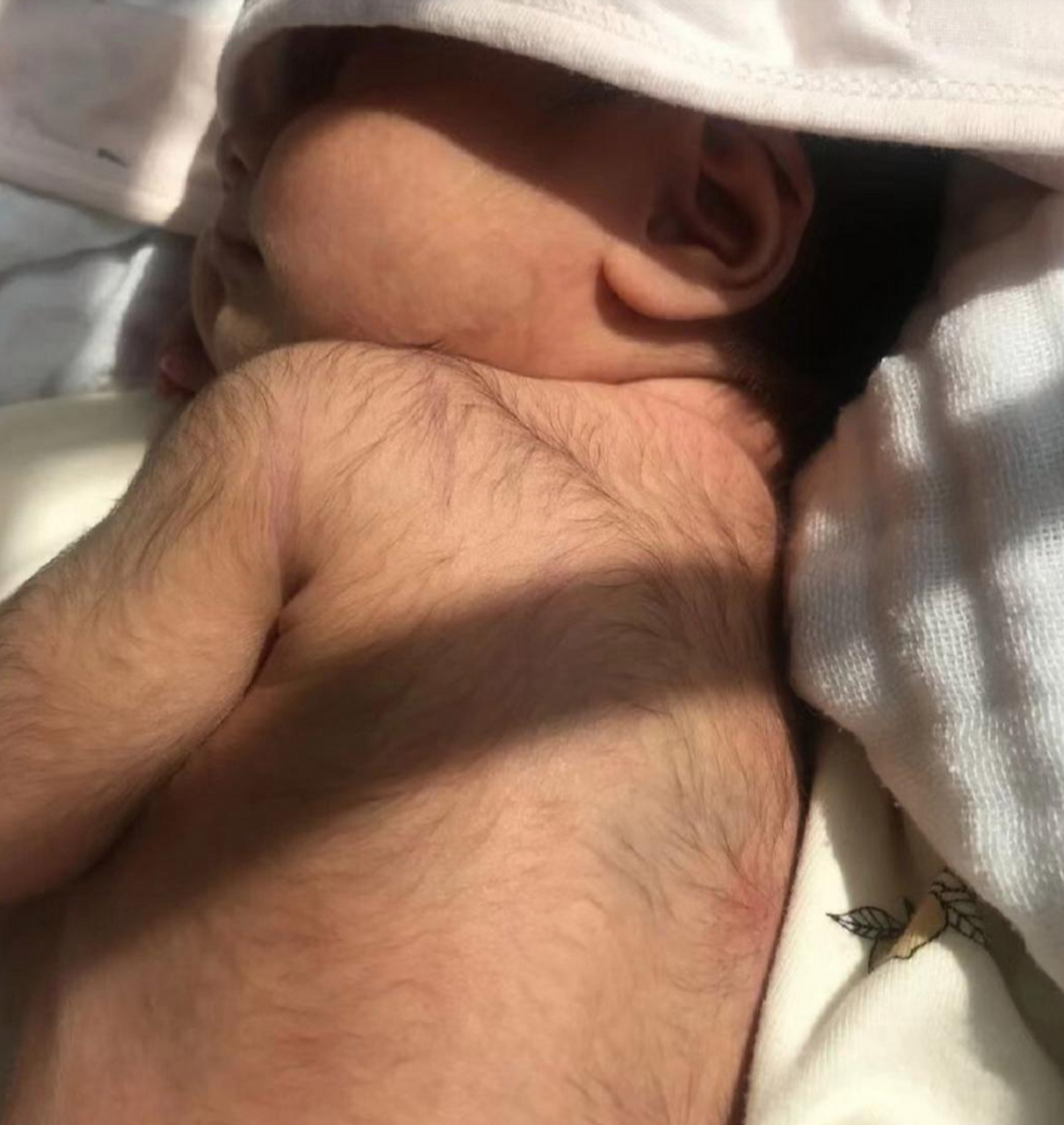 刚出生的小孩体毛都这么重吗