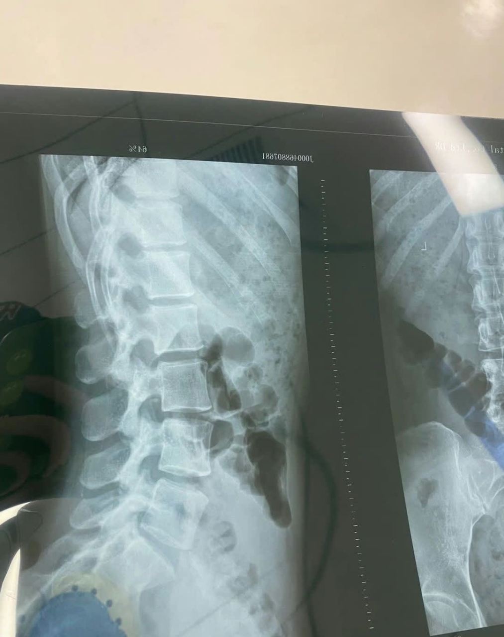 不好意思,他用脚挖出了一间三房一厅的房间[抠鼻]