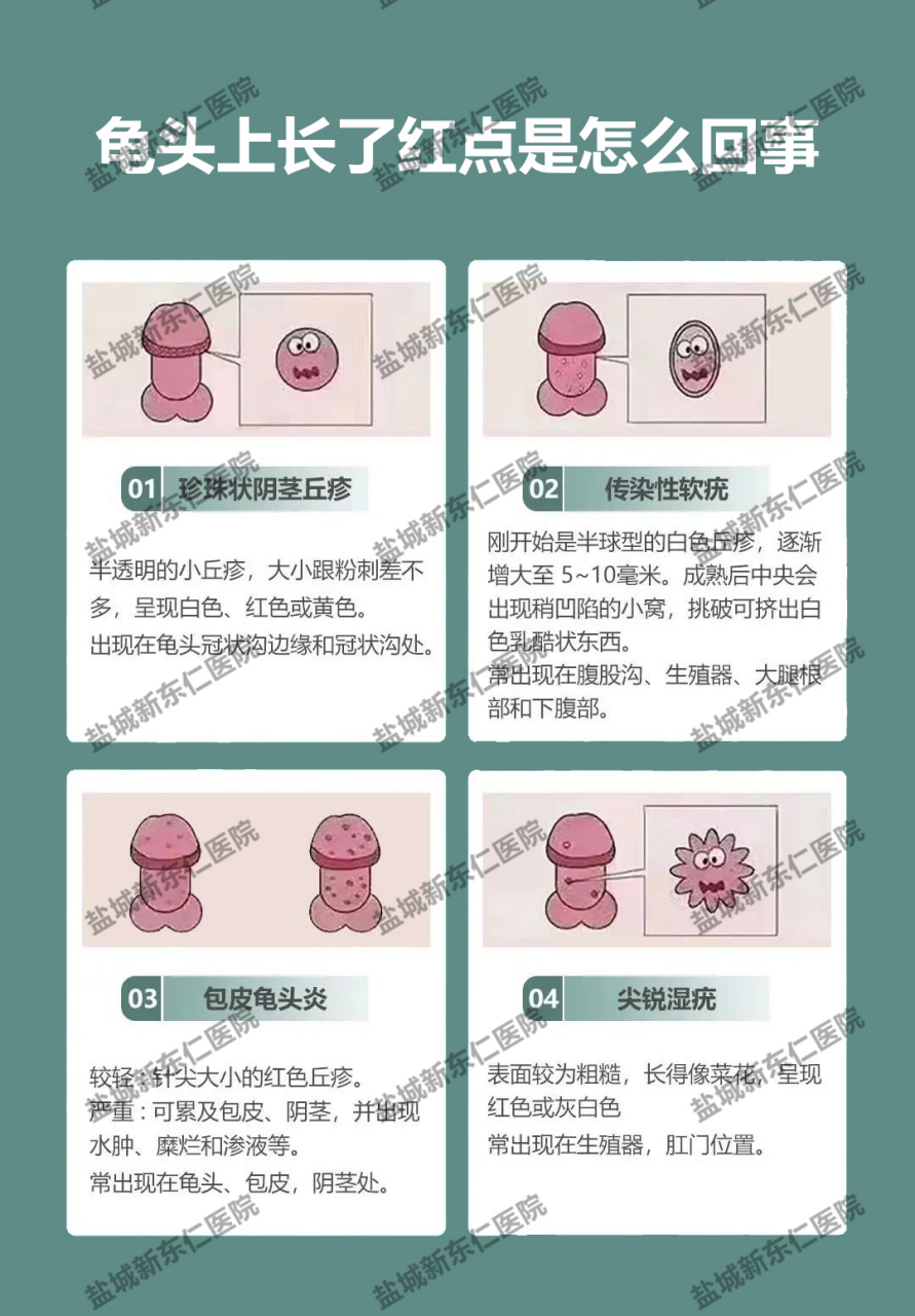 盐城新东仁男科# #盐城龟头长红点# #盐城龟头上长了红点是怎么回事