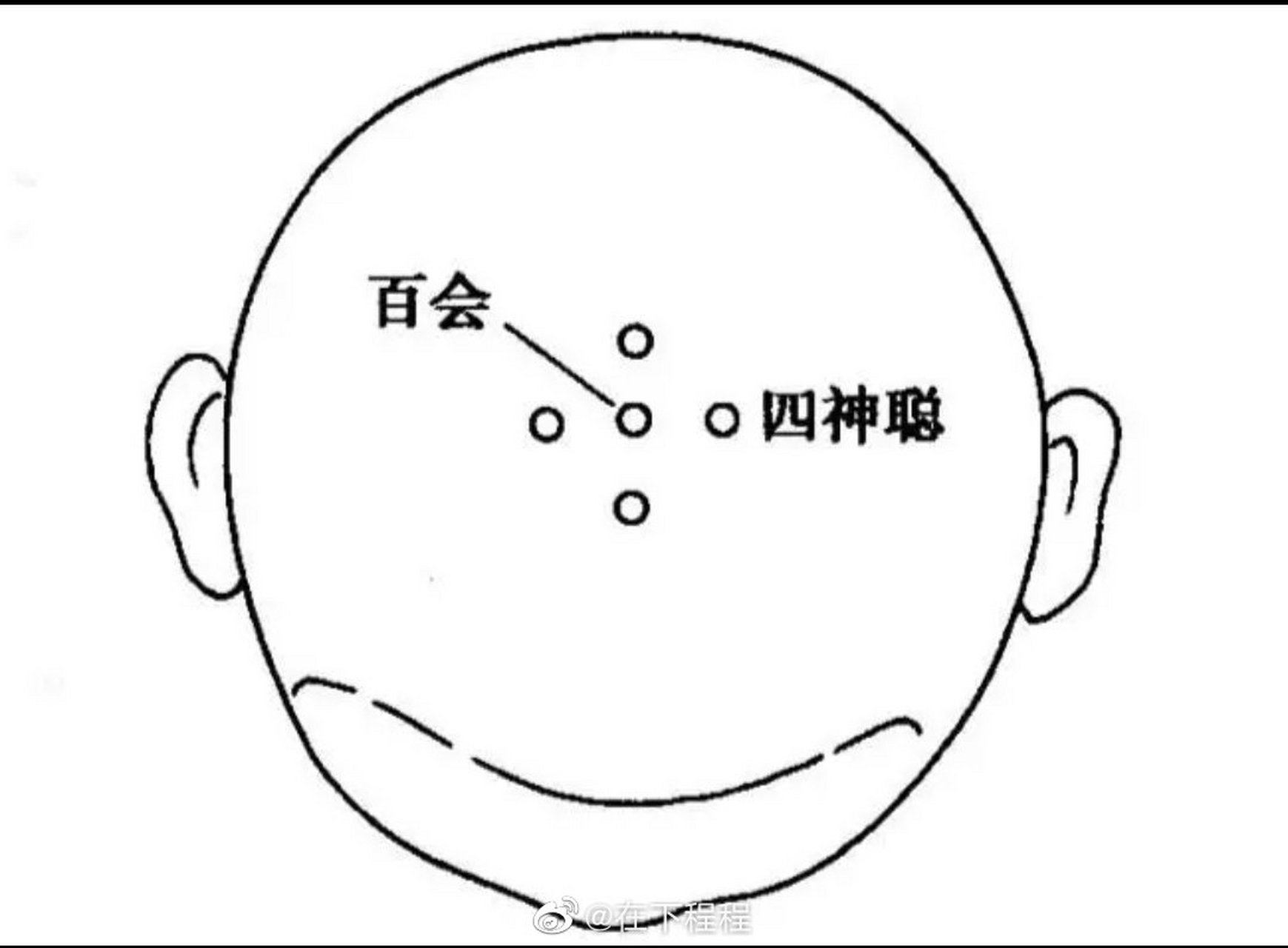 把四神聪连成线,形成一个四边形.